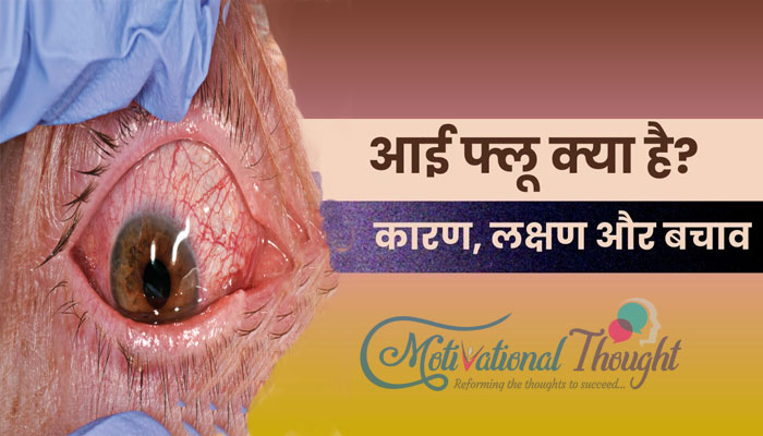 Eye Flu | आई फ्लू क्या है? जानें इसके लक्षण, कारण, बचाव और इलाज