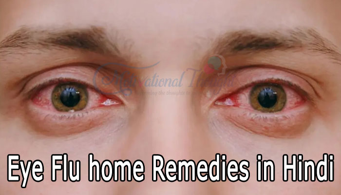 आई फ्लू घरेलु उपाय | Eye Flu home Remedies in Hindi